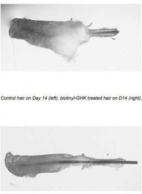 Hair growth after 14 days using biotinoyl GHK