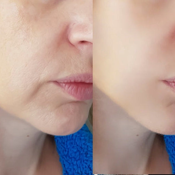 Contour Max Plumps Skin Naturally •Anti-Aging/wrinkle •Toning •Improved Skin Elasticity & Tone •Improved Skin Appearance